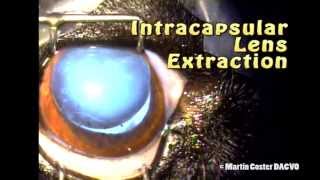 Lens Luxation Surgery in a Dog Intracapsular Lens Extraction ICLE [upl. by Alaek661]