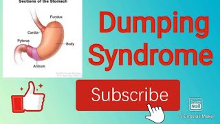 Dumping syndrome [upl. by Dlarej]