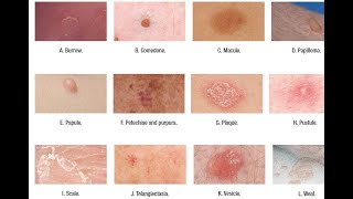 Skin Lesions with defination [upl. by Skippy]