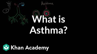 Asthma Explained Clearly Remastered  Pathophysiology Diagnosis Triggers [upl. by Roinuj]