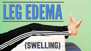 Top 7 Exercises for Leg Edema or Swelling Program or Protocol for Edema [upl. by Culhert334]