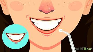 How to Straighten Your Teeth Without Braces [upl. by Idham]