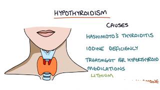 Hypothyroidism and Hashimotos Thyroiditis Visual Explanation for Students [upl. by Florence730]