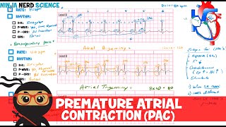 Rate and Rhythm  Premature Atrial Contraction PAC [upl. by Stafani798]